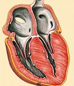 Гипертрофическая кардиомиопатия (ГКМП)