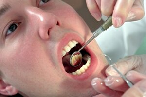 Киста зуба: причины, симптомы, лечение. Фото.